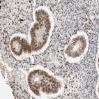 Anti-PUS7 Antibody