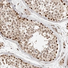 Immunohistochemical staining of human testis shows moderate to strong nuclear positivity in cells in seminiferous ducts.