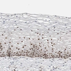 Immunohistochemical staining of human cervix, uterine shows moderate to strong nuclear positivity in squamous epithelial cells.