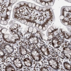 Immunohistochemical staining of human gastrointestinal shows strong nuclear positivity in glandular cells.