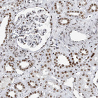 Immunohistochemical staining of human kidney shows moderate nuclear positivity in cells in glomeruli and tubules.