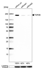 Western blot analysis in U2OS cells transfected with control siRNA, target specific siRNA probe #1 and #2, using Anti-TOP2B antibody. Remaining relative intensity is presented. Loading control: Anti-GAPDH.