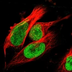 Immunofluorescent staining of human cell line U-251 MG shows localization to nucleoplasm.
