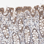 Immunohistochemical staining of human gastrointestinal shows moderate cytoplasmic positivity in glandular cells.