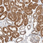 Immunohistochemical staining of human kidney shows strong cytoplasmic positivity in cells in tubules.