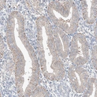 Immunohistochemical staining of human endometrium shows moderate cytoplasmic positivity in glandular cells.