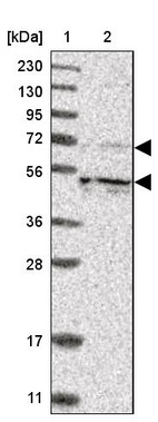 Lane 1: Marker [kDa] 230, 130, 95, 72, 56, 36, 28, 17, 11_br/_Lane 2: Human cell line RT-4