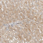 Immunohistochemical staining of human liver shows moderate cytoplasmic positivity in hepatocytes.