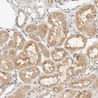 Immunohistochemical staining of human kidney shows moderate cytoplasmic positivity in cells in tubules.