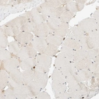 Immunohistochemical staining of human skeletal muscle shows no positivity in myocytes as expected.