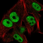 Immunofluorescent staining of human cell line SK-MEL-30 shows localization to nucleoplasm.