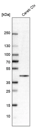 Western blot analysis in human cerebral cortex tissue.