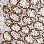 Anti-TSPAN32 Antibody