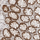 Anti-TSPAN32 Antibody