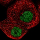 Anti-ZBTB11 Antibody