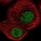 Immunofluorescent staining of human cell line A-431 shows localization to nucleoplasm.