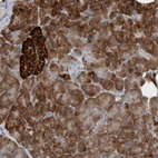 Anti-USP25 Antibody