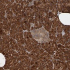 Anti-AGBL3 Antibody