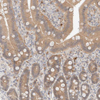 Immunohistochemical staining of human gastrointestinal shows moderate cytoplasmic positivity in glandular cells.