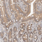 Immunohistochemical staining of human gastrointestinal shows moderate cytoplasmic positivity in glandular cells.