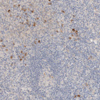 Immunohistochemical staining of human lymphoid tissues shows moderate cytoplasmic positivity in lymphoid cells.