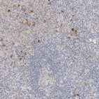 Immunohistochemical staining of human lymphoid tissues shows moderate cytoplasmic positivity in lymphoid cells.