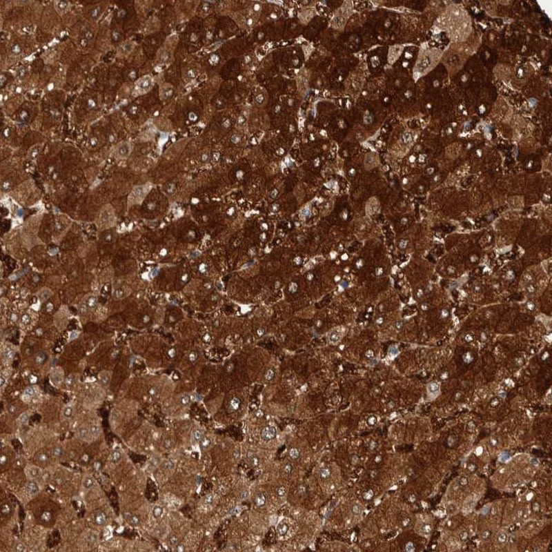 Anti-ZNF862 Antibody