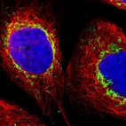 Immunofluorescent staining of human cell line A-431 shows localization to mitochondria.