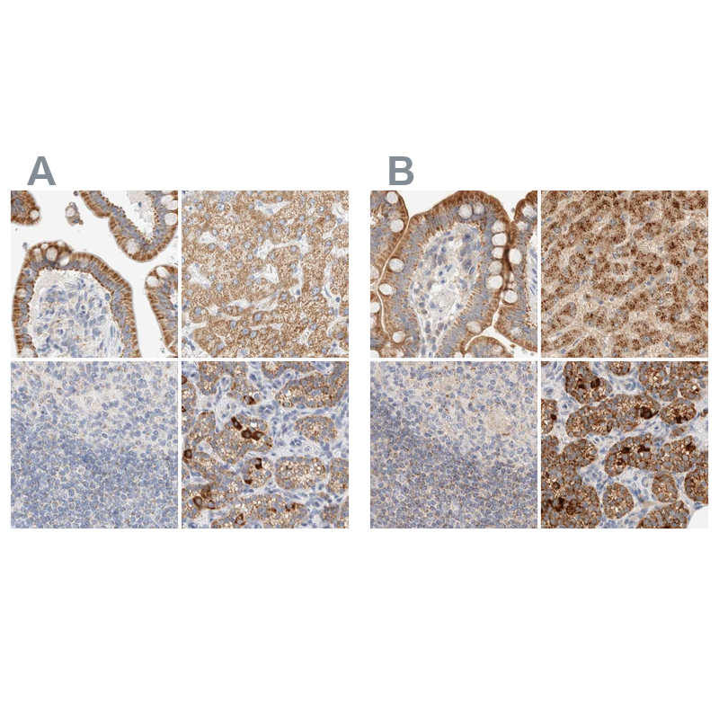 Anti-HDHD3 Antibody