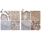 Anti-HDHD3 Antibody