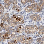 Immunohistochemical staining of human parathyroid gland using Anti-HDHD3 antibody HPA024158.