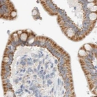 Immunohistochemical staining of human colon using Anti-HDHD3 antibody HPA024158.