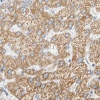 Immunohistochemical staining of human liver using Anti-HDHD3 antibody HPA024158.