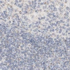 Immunohistochemical staining of human lymph node using Anti-HDHD3 antibody HPA024158.
