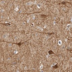 Anti-DCAF10 Antibody