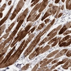 Immunohistochemical staining of human heart muscle shows strong cytoplasmic positivity in cardiomyocytes.