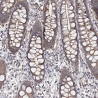 Immunohistochemical staining of human rectum shows moderate cytoplasmic positivity in glandular cells.