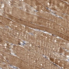 Immunohistochemical staining of human skeletal muscle shows strong cytoplasmic positivity in myocytes.