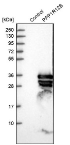 Anti-PPP1R12B Antibody