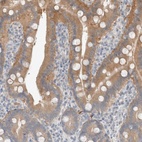 Anti-TRIT1 Antibody