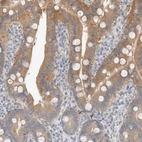 Anti-TRIT1 Antibody
