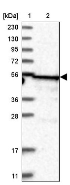 Lane 1: Marker [kDa] 230, 130, 95, 72, 56, 36, 28, 17, 11_br/_Lane 2: Human cell line RT-4