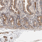 Anti-SIPA1L2 Antibody