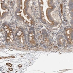 Anti-SIPA1L2 Antibody