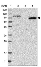 Lane 1: Marker [kDa] 230, 130, 95, 72, 56, 36, 28, 17, 11_br/_Lane 2: Human cell line RT-4_br/_Lane 3: Human cell line U-251MG sp_br/_Lane 4: Human plasma (IgG/HSA depleted)