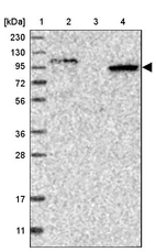 Lane 1: Marker [kDa] 230, 130, 95, 72, 56, 36, 28, 17, 11_br/_Lane 2: Human cell line RT-4_br/_Lane 3: Human cell line U-251MG sp_br/_Lane 4: Human plasma (IgG/HSA depleted)