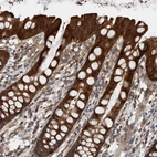 Immunohistochemical staining of human Rectum shows strong cytoplasmic positivity in glandular cells.