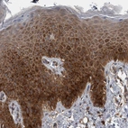 Immunohistochemical staining of human Skin shows moderate cytoplasmic positivity in squamous epithelial cells.