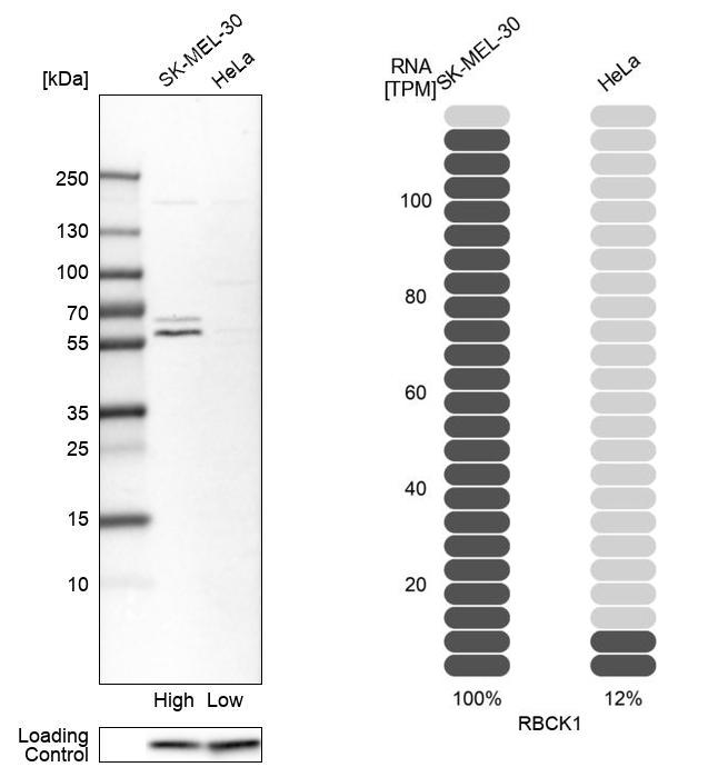 Anti-RBCK1 Antibody