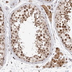 Anti-HESX1 Antibody